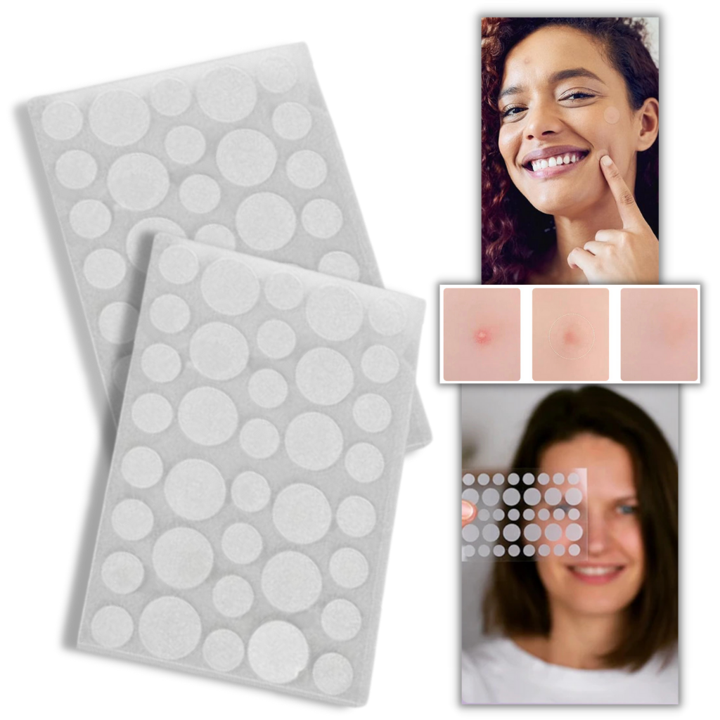 36-Pack Invisible Acne Patches