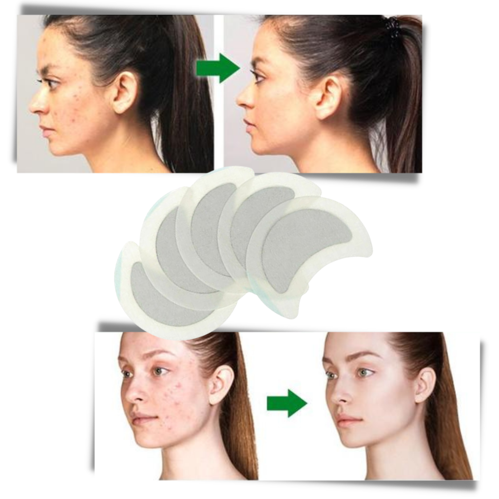 5 x Anti-Sweat Herbal Lymph Patches