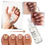 7 Days Nail Repair Essence