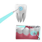 Deep Cleaning Tooth Tartar Machine