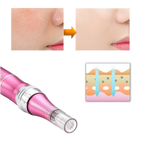 Dermal Microneedling Pen
