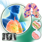 Breath Ease Natural Spray