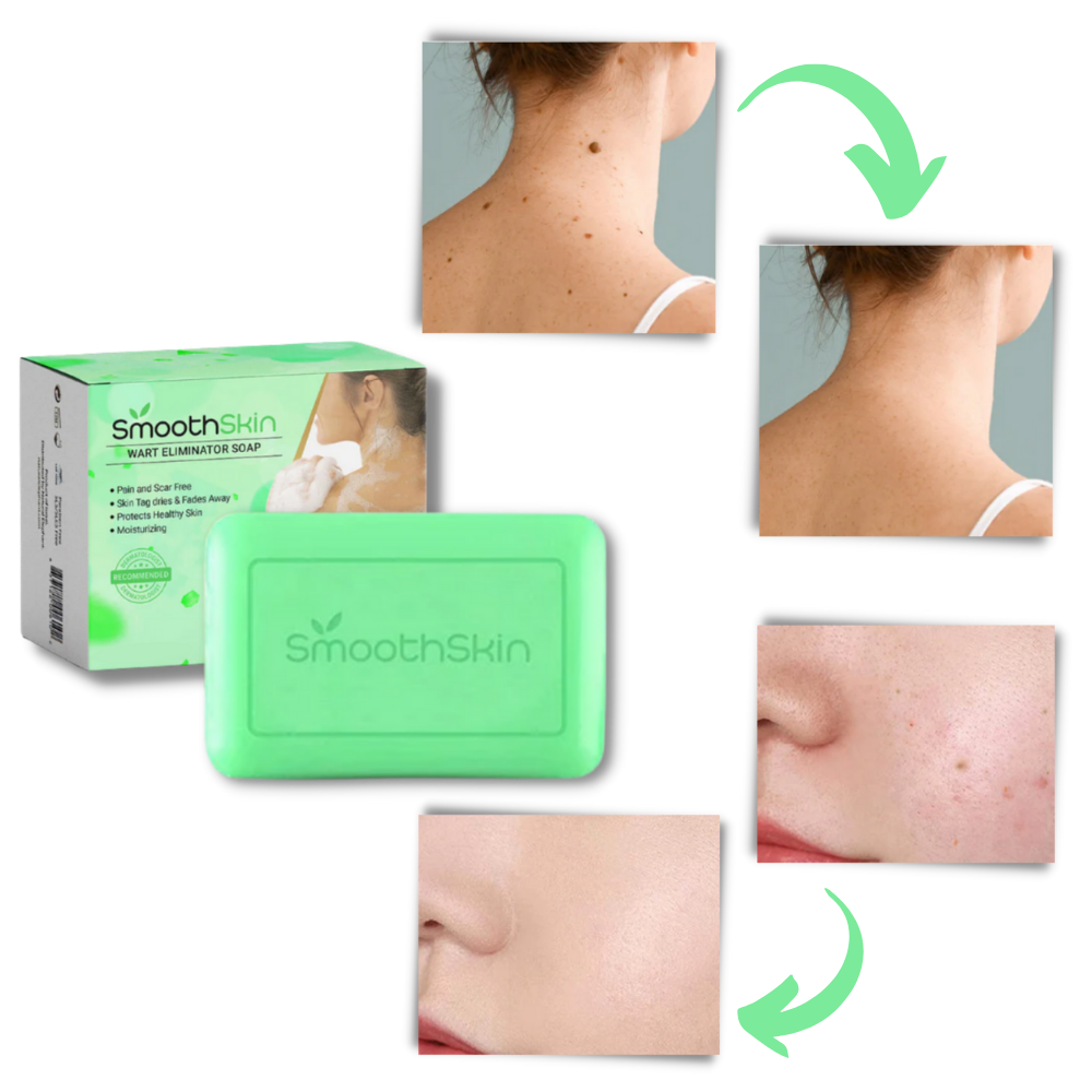 Moisturizing Exfoliator Wart Removal Soap
