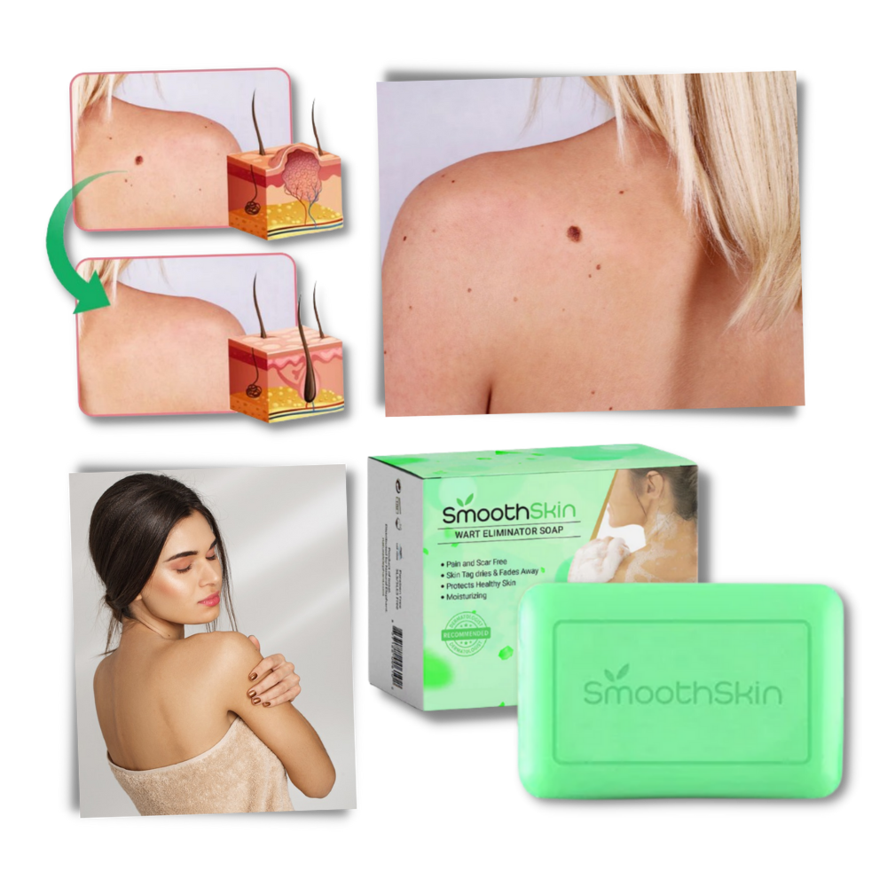 Moisturizing Exfoliator Wart Removal Soap