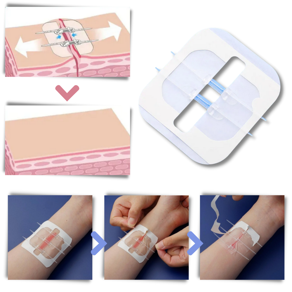 Water-proof wound adhesive