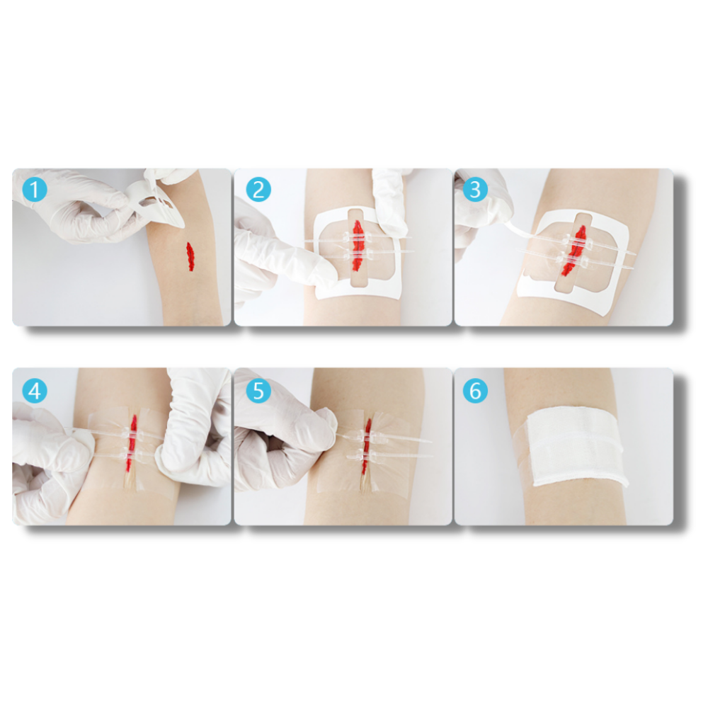 Water-proof wound adhesive