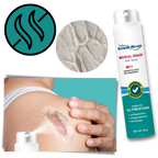 Scar Removal Spray Therapy