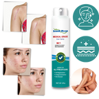 Scar Removal Spray Therapy