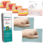 Scar Removal Spray Therapy