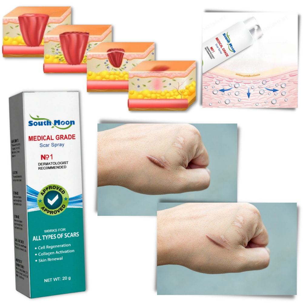 Scar Removal Spray Therapy