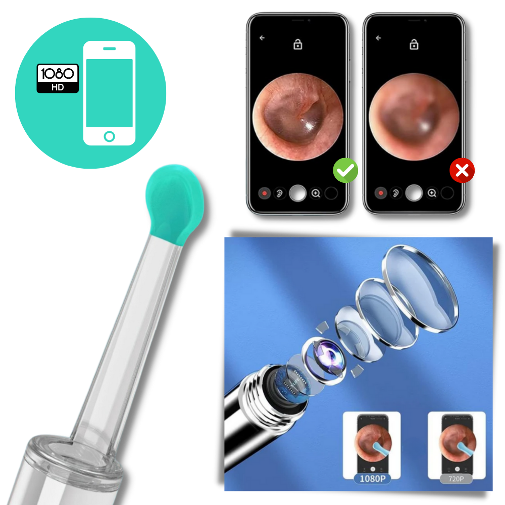 Smart Ear Wax Removal Camera