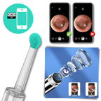 Smart Ear Wax Removal Camera