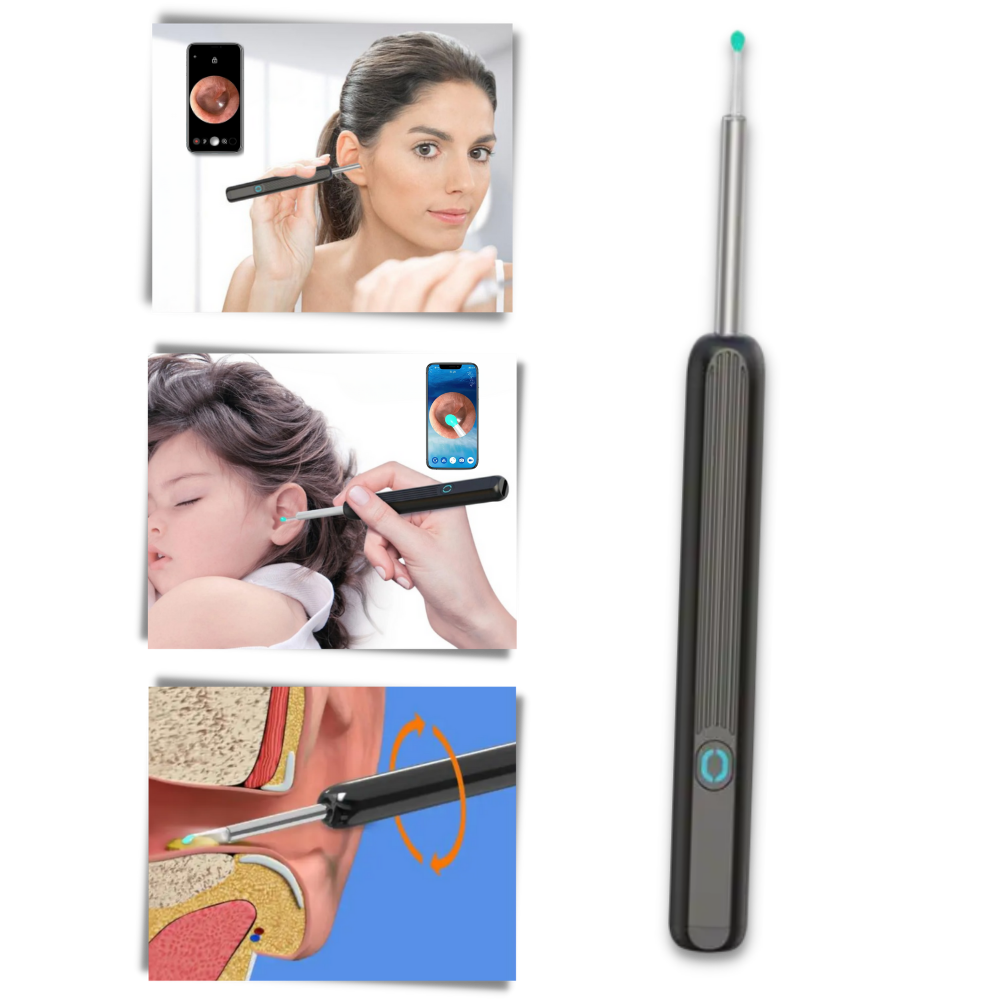 Smart Ear Wax Removal Camera