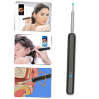 Smart Ear Wax Removal Camera