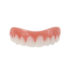 Snap-On Veneer Teeth