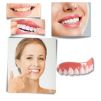 Snap-On Veneer Teeth
