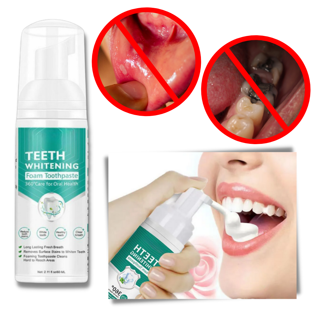 Teeth Whitening Foam