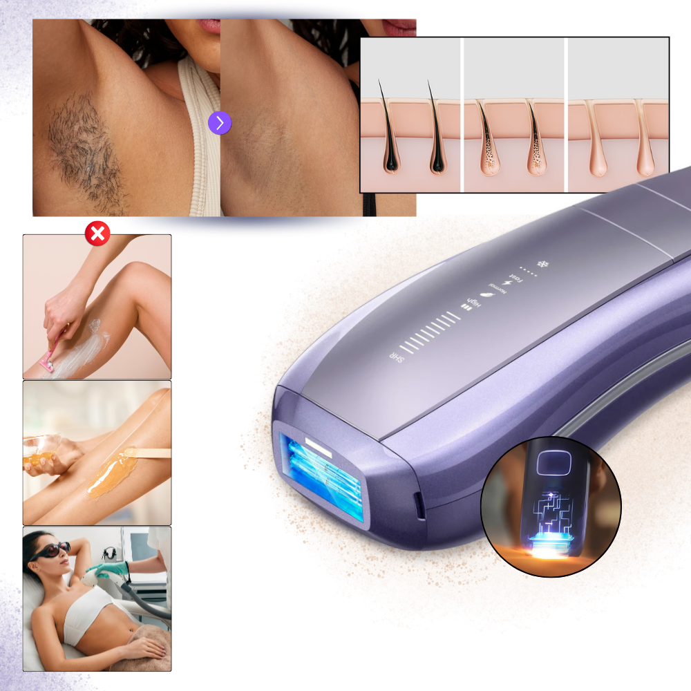 SkinSync Hair Removal Device